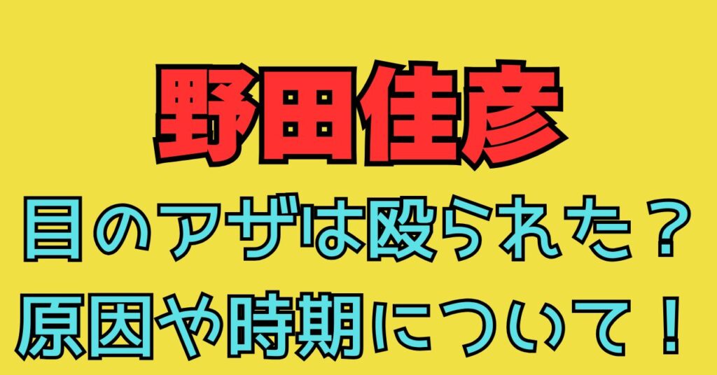 野田佳彦　画像　右目　アザ　青タン　殴られた　怪我　原因　いつから